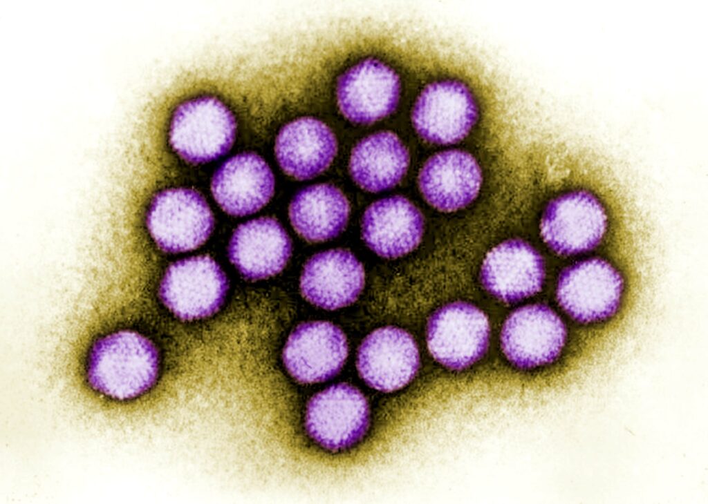visione al microscopio di adenovirushttps://pixnio.com/it/scienza/immagini-microscopio/colorato-la-trasmissione-microscopio-elettronico-adenovirus 
